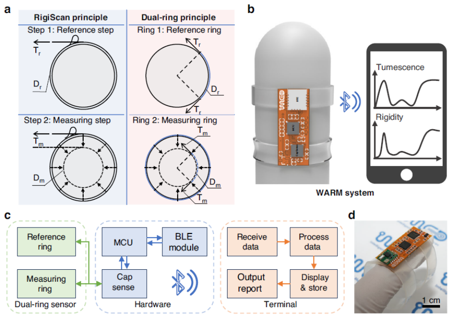 Figure 1. Wearable Adaptive Rigidity Monitoring (WARM) System.